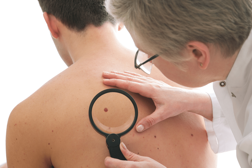 dermatologist looking at the back of a patient